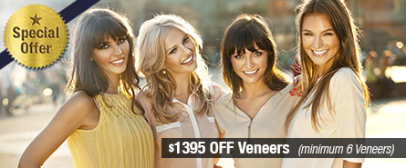 Veneers Special Offer