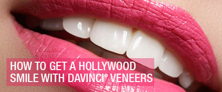 daVinci® Veneers