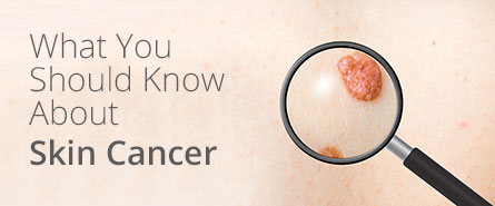 Skin Cancer