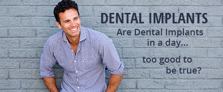 Dental Implants